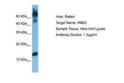 MRPL23 Rabbit anti-Human, Polyclonal, Novus Biologicals 0.1ml; Unconjugated:Antibodies,